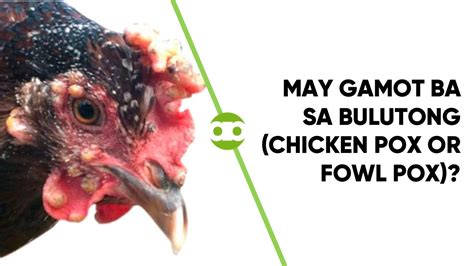 gamot sa bulutong na may nana|Chickenpox .